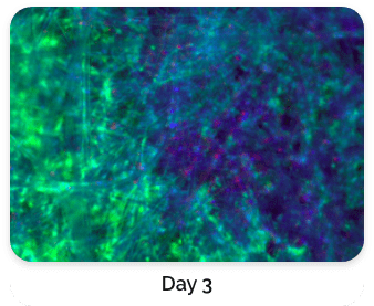 Live Cell Staining with Fluorescence Dyes day 3